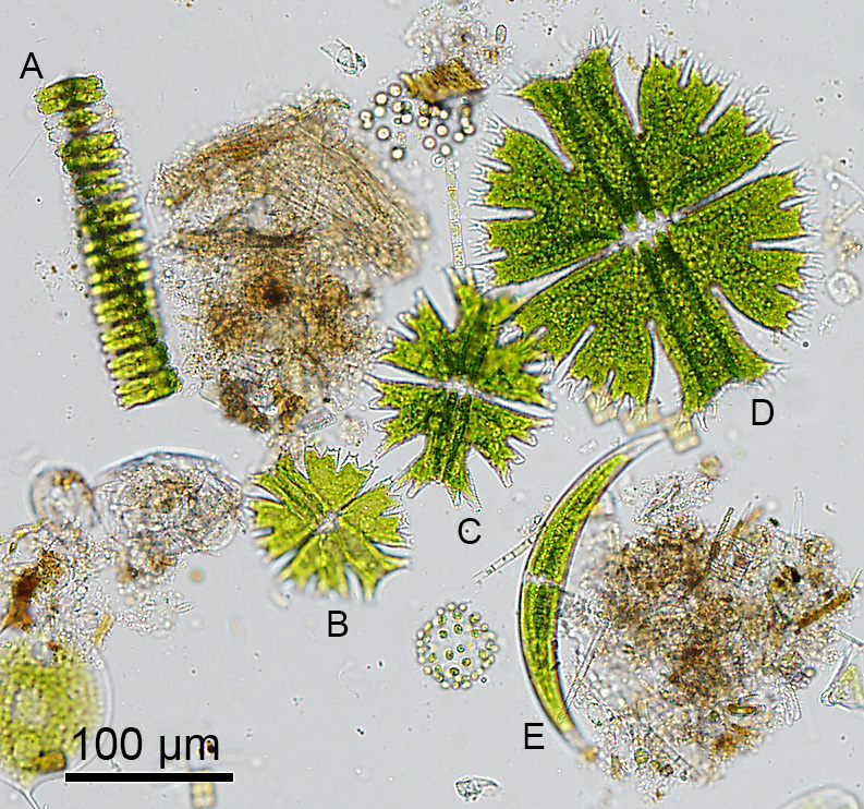 Fra venstre mod højre A. Desmidium swartzii, B. Micrasterias crux-melitensis, C. M. americana, D. M. apiculata og E. Closterium dianae. Arterne C og D er rødlistet i flere europæiske lande.